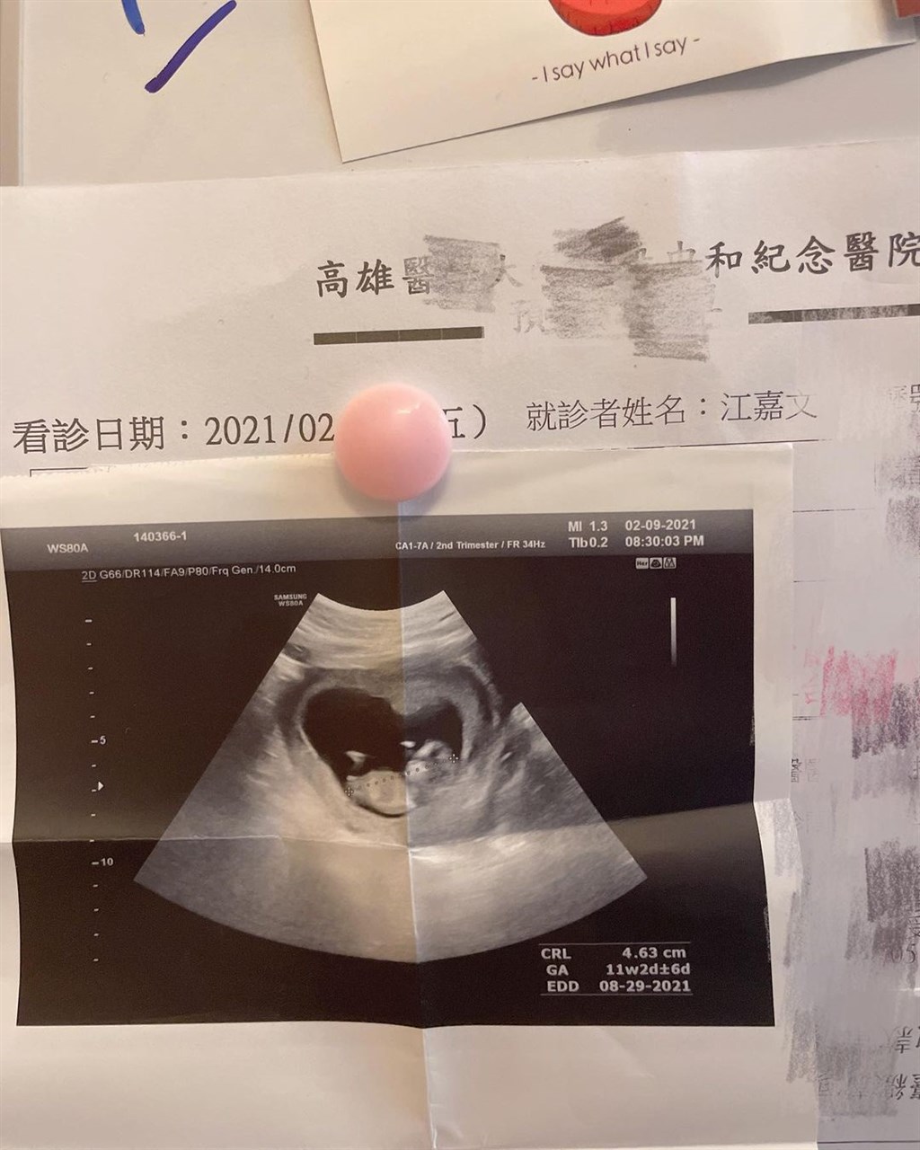 變性網紅罔腰18日在IG貼出在高醫做的腹部超音波紀錄單,公布懷孕喜訊。(圖取自instagram.com/wen810615)