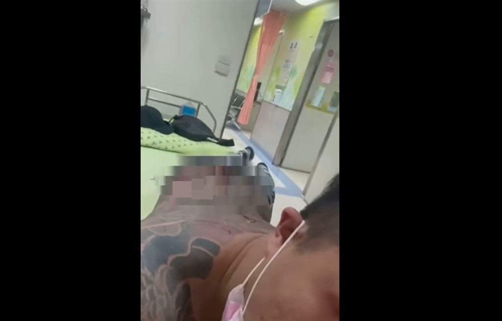 以夾娃娃教學影片起家的YouTuber「含羞草日記」在臉書粉專和IG指出,團隊副團長「超艾夾」22日上午在高雄苓雅區遇襲,背部更身中2刀。(facebook.com/bigmimosa)