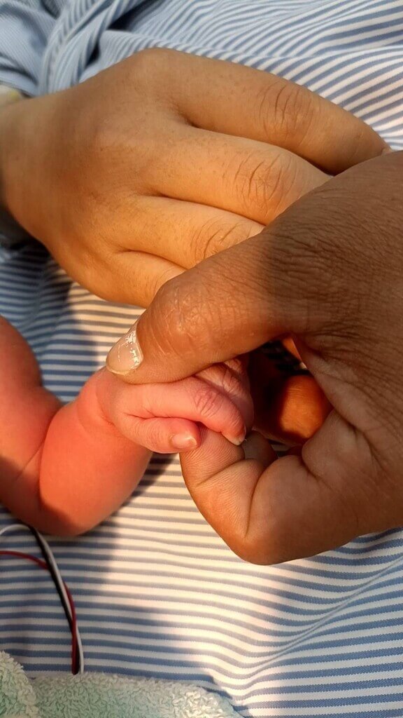 確診孕婦提前破水屏基團隊剖腹順產女嬰 生活 中央社cna