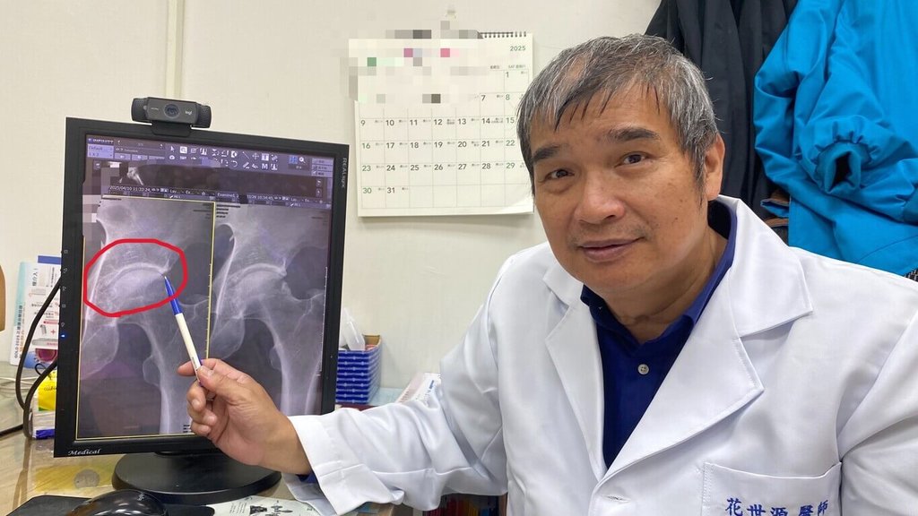 長期蹲下關節痛 裝潢師傅罹患髖關節夾擊症候群