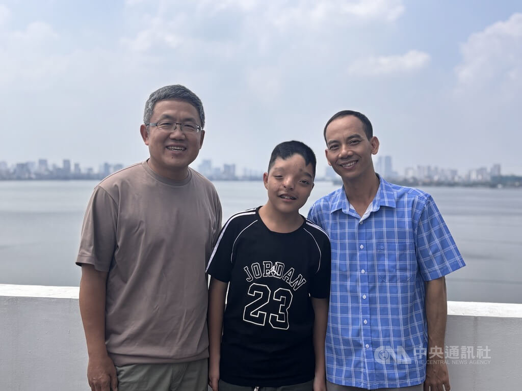 駐越南代表劉世忠與顱顏患者合照