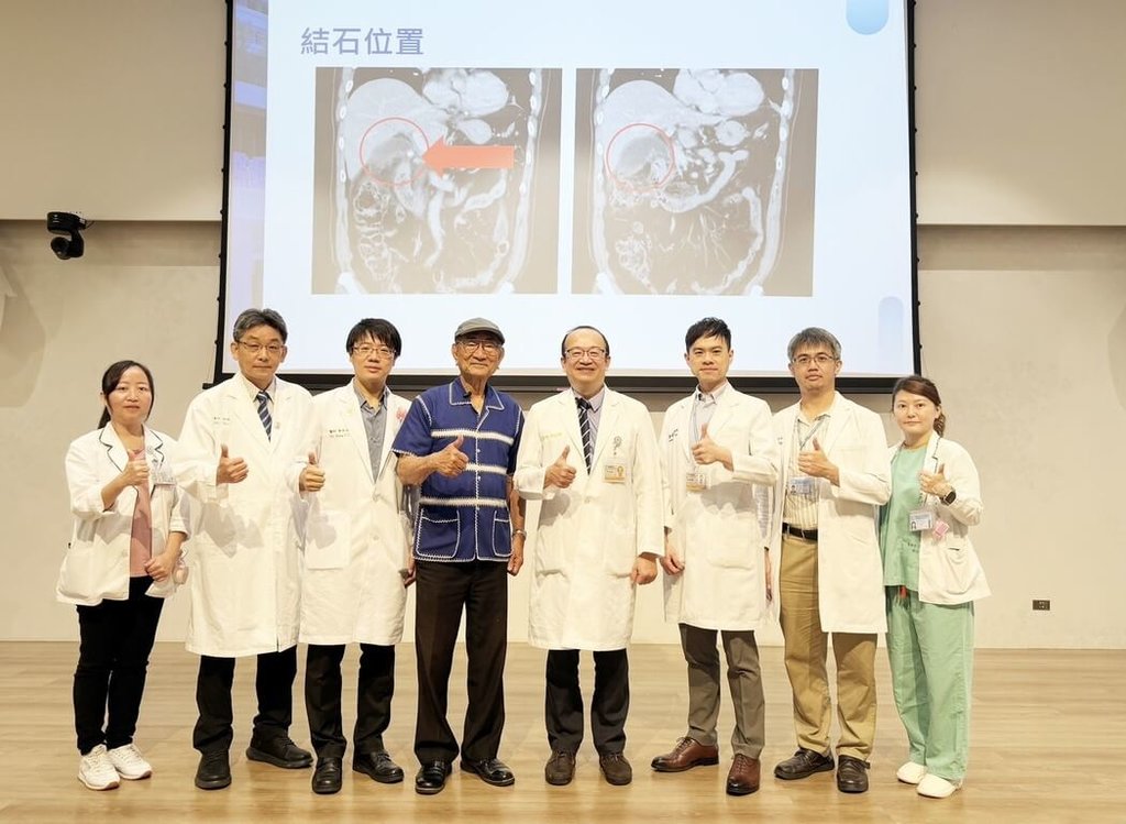 台中牧師膽囊結石合併急性發炎　經驗分享