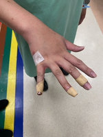 休旅車拒攔查倒車衝撞  警員受傷開槍送醫無礙