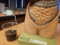 大便色像葡萄酒不是大腸癌 竟是血管異常增生惹禍