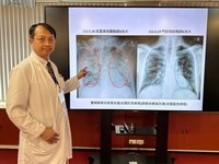 男子流感合併呼吸窘迫  葉克膜搶救17天