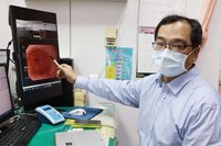 上班族黑咖啡當水喝 胸口刺痛檢出嚴重十二指腸潰瘍