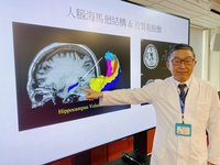 中榮成立臨床腦科學研究中心 致力研究思覺失調症