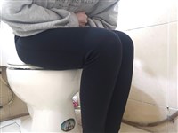 過年胖3公斤、只排便1次 女上班族罹腸漏症