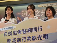 認識纏身麥可傑克森的白斑症 醫師破除4迷思