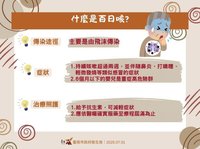 台南114年第3例百日咳 病患是第2例同住母親