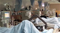 慢性腎病莫輕忽「皮蛇」  洗腎風險恐倍增