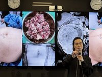 女罹子宮肌瘤肚大如懷孕　微創擺脫痛又醜困擾