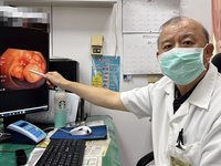 婦人3個月暴瘦10公斤　以為瘦身成功卻罹大腸癌