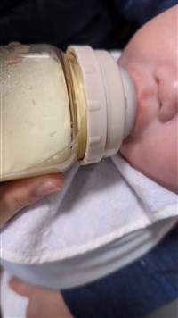 從癱軟到能抬頭　關愛之家腦傷兒復健3年迎希望