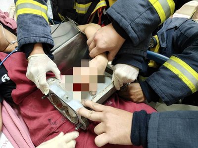 台中餅店女員工手指捲入機台 市府啟動稽查