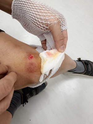 北市男通緝犯遇盤查逃逸遭逮、友人傷警　均送辦