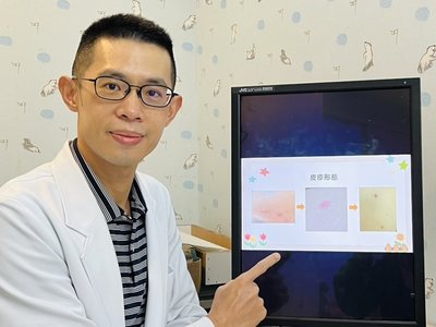 出遊全身紅疹以為蟲咬 多日不退才知長水痘