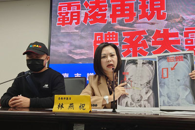 台南男童疑遭同補習班學生逼吞磁鐵　市府啟動調查