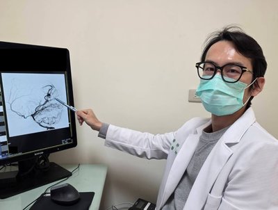 女子突發劇烈頭痛　醫揪出腦血管病變緊急拆彈