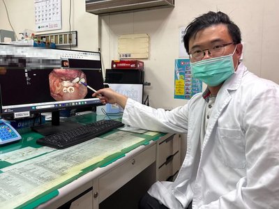 長期忽視家族病史　男子首度篩檢發現大腸6顆腫瘤