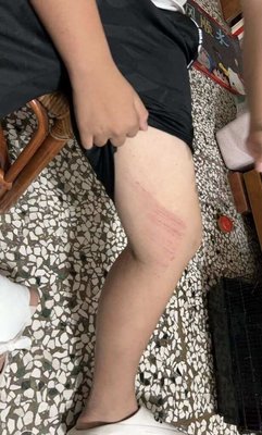 3流浪狗追國中生連人帶車摔水溝　彰縣動防所調查