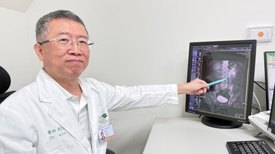 廚師把珍奶當白開水喝 輸尿管結石卡住急性腎水腫