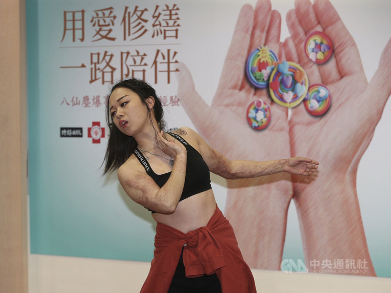 八仙塵爆傷友黃品諭（圖）傷後因腿上有疤、肌肉無力，完全無法蹲。她靠驚人意志跳舞，點滴練習，17日出席「用愛修繕一路陪伴：八仙塵爆事件之馬偕經驗」新書發表會，表演苦練的舞蹈。中央社記者徐肇昌攝　108年6月17日