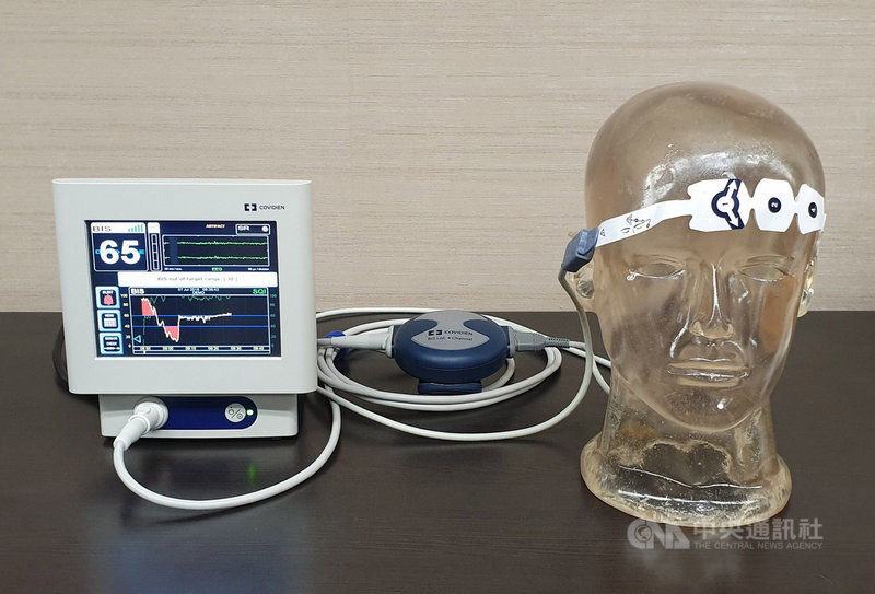 術後加速康復療程(ERAS)是創新整合醫療架構,從術前、術中麻醉、術後恢復,以實證醫學的確認結論為治療方針,術中會用各種監測儀器,掌握病人水分、麻醉深度,避免相關併發症。中央社記者陳偉婷攝 108年7月7日