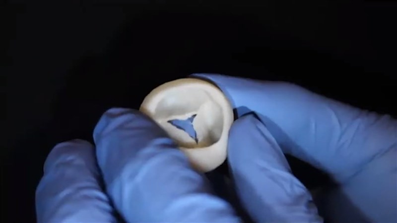 美國科學家們成功以膠原蛋白為原料，用3D生物印表機作出能在人體運作的心臟瓣膜。（圖取自College of Engineering, Carnegie Mellon University YouTube頻道網頁youtube.com）