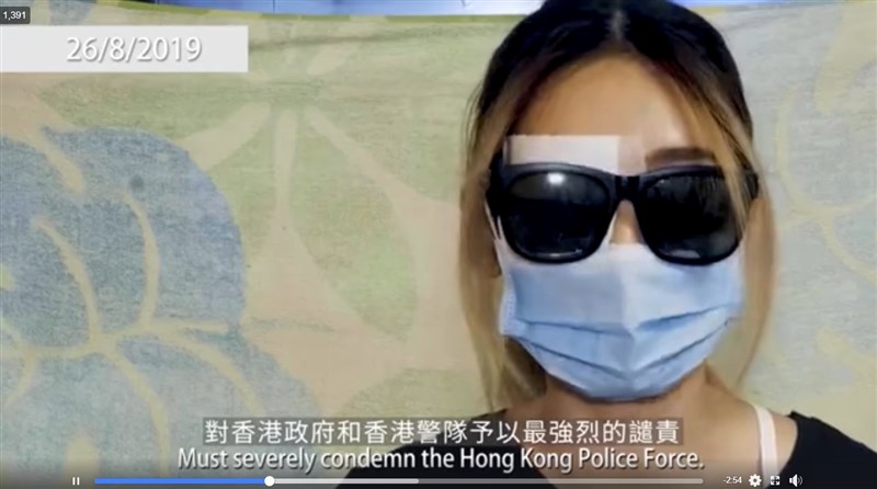 香港網民發起的民間記者會29日下午播出尖沙咀示威衝突中右眼受傷女子的談話短片,她戴著墨鏡、口罩,右眼則蒙著紗布。(圖取自facebook.com/standnewshk)