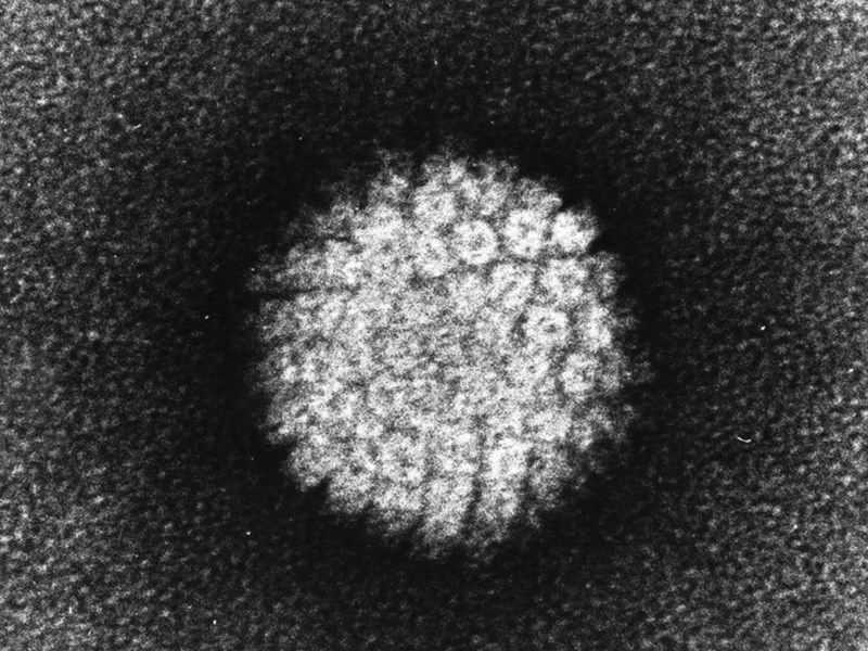 醫師表示,人類乳突病毒(HPV)感染是一種性傳染病,但除了性行為之外,仍可能出現接觸傳染個案。圖為電子顯微鏡下的人類乳突病毒。(圖取自維基共享資源,版權屬公有領域)