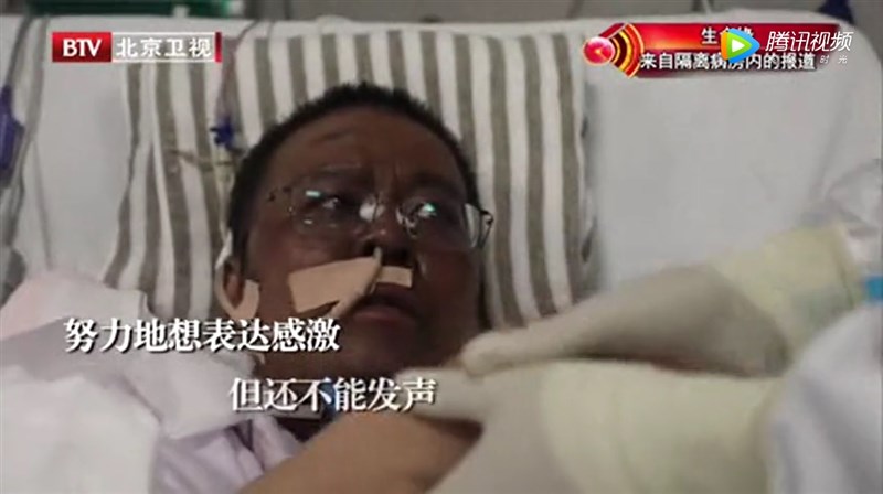 根據中國環球時報報導,兩名染武漢肺炎的湖北省醫師雖然逃過死劫,卻全身暗沉整臉發黑。(圖取自騰訊視頻網頁v.qq.com)