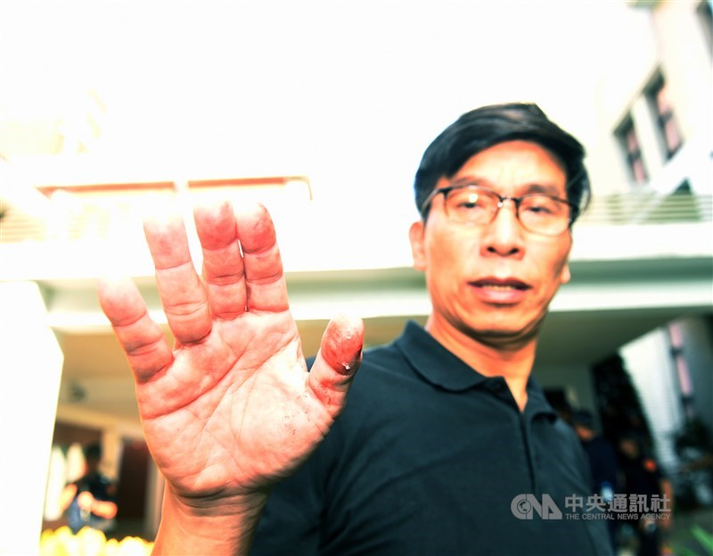立法院臨時會本週處理監察院人事案,14日上午將進行監察院長被提名人陳菊審查會,一早藍綠立委在議場後門發生推擠衝突,民進黨立委鍾佳濱(圖)的手受傷流血。中央社記者施宗暉攝 109年7月14日