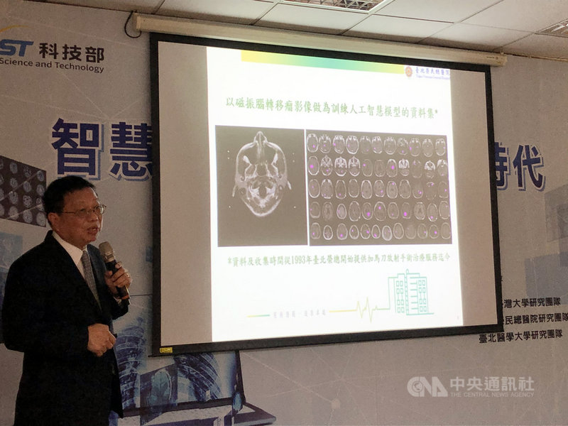科技部20日舉行智慧醫療研究成果記者會,台北榮民總醫院放射線部主任郭萬祐解釋,腦轉移瘤AI輔助診斷系統是以台北榮總過去30年由專業放射科醫師所標註1000筆以上個案作初始模型訓練。中央社記者蘇思云攝 109年8月20日