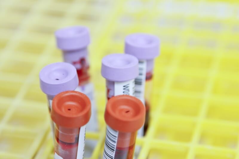 中央流行疫情指揮中心2月20日宣布，今年度COVID-19血清抗體陽性率監測即將開跑，1至6月預計抽樣捐血人7000名。（示意圖／圖取自Unsplash圖庫）