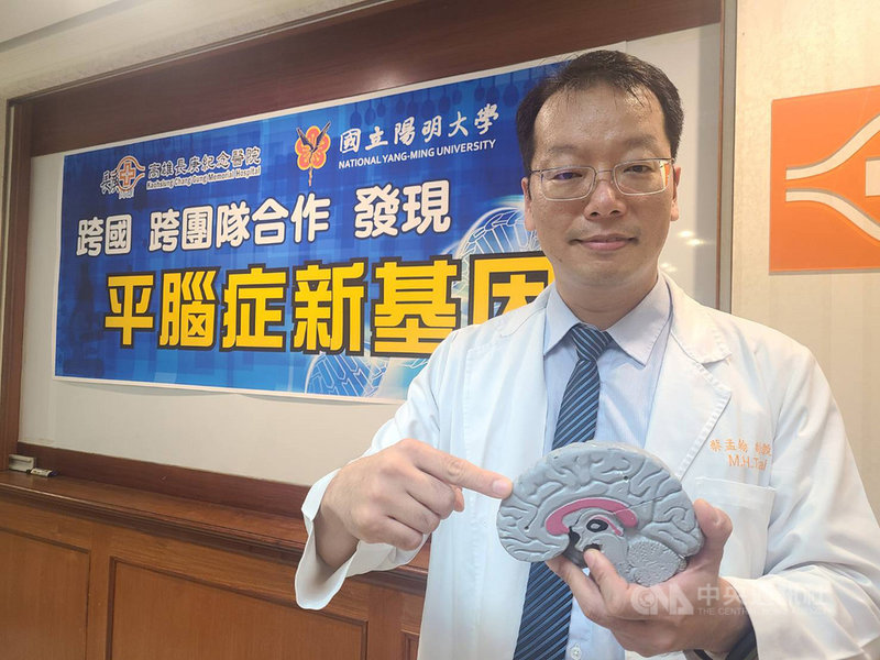 「平腦症」是一種腦部較平滑、無皺褶的罕見神經疾病,恐伴隨嚴重發展及認知障礙。高雄長庚醫院腦功能暨癲癇科科主任蔡孟翰(圖)與陽明研究團隊耗時多年,找出平腦症致病新基因,助全球12名患者找出病因,登國際期刊。中央社記者張茗喧攝 109年9月22日