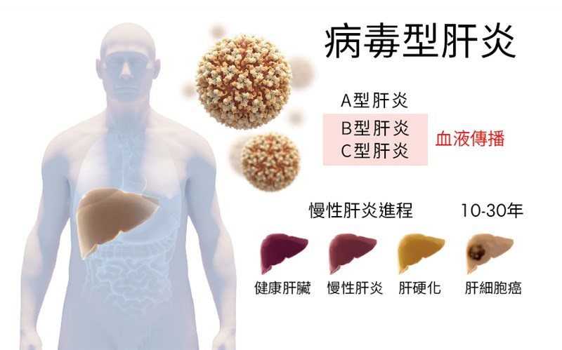 2020年諾貝爾醫學獎3名得主的研究都與C型肝炎病毒有關。C肝雖然不像B肝一樣有疫苗可防,但已有藥物可以治癒,有效防範感染後演變成慢性肝炎、肝硬化或肝癌。(圖取自諾貝爾獎官網nobelprize.org)