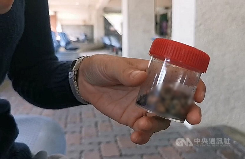 嘉義一名鄭姓女子4日到嘉義基督教醫院處理蛀牙,牙醫師診斷後一次拔20顆牙,鄭女返家休養卻在5日昏迷命危,送往另家醫院治療至13日拔管,院方開立死因為肺炎,家屬報警求真相,嘉義地檢署已安排18日解剖。(民眾提供) 中央社記者姜宜菁傳真 109年11月17日