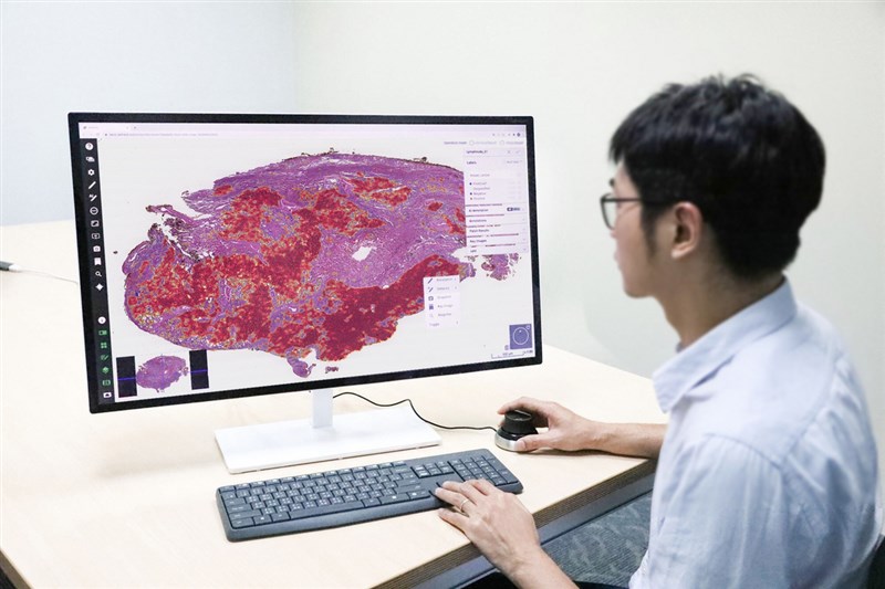 台北醫學大學巨量影像資料庫研究計畫,以人工智慧AI 系統開發肺部腫瘤不需人工標註的病理影像辨識系統,準確率達95%以上,且每名病人僅須3到5分鐘就可判讀。(北醫大提供)中央社記者陳偉婷傳真 110年2月26日
