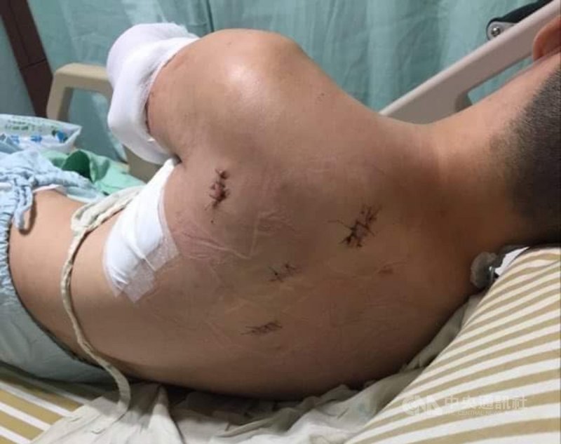 李姓男子日前到基隆一間KTV飲酒歡唱巧遇前女友,帶著酒意前往敬酒,引起施姓現任男友不滿,雙方發生口角,李男找人助陣,其中一男子持刀刺傷施男背部遭送辦。(讀者提供)中央社記者王朝鈺傳真 110年3月7日