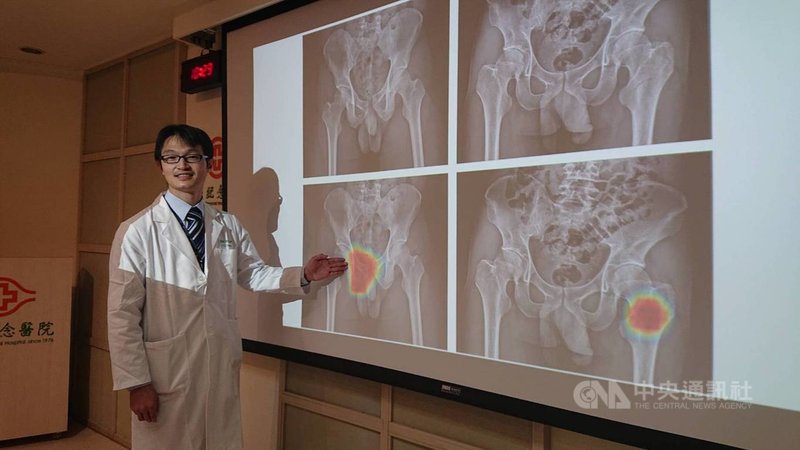 林口長庚醫院外傷急症外科主治醫師鄭啟桐(圖)20日在記者會中表示,骨盆骨折造成大量出血比內臟出血難偵測,一旦延誤治療死亡率達3成。中央社記者陳婕翎攝 110年4月20日