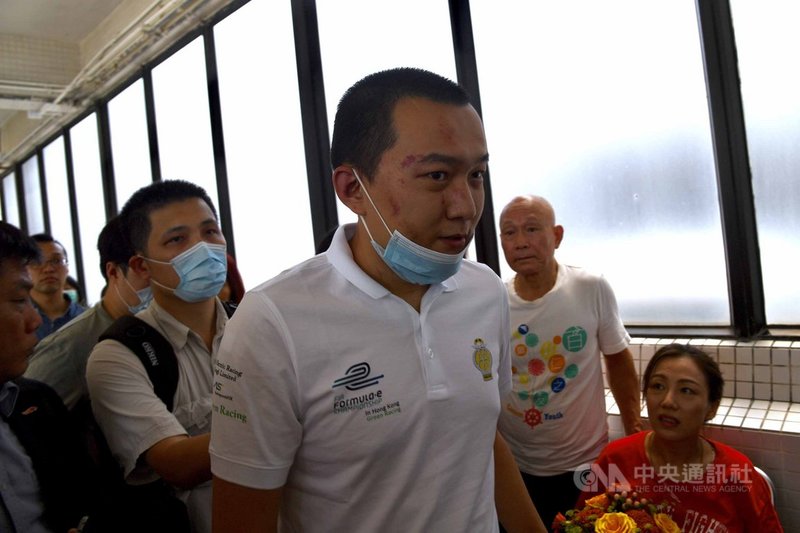 2019年在香港機場一度被「反送中」示威者圍毆的環球時報記者付國豪,20日傳出因為收入經濟狀況難在北京安身,加上家庭因素,只好離開環時。圖為2019年8月14日,付國豪離開香港瑪嘉烈醫院。(中新社提供)中央社 110年4月21日