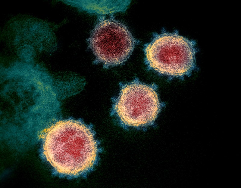 COVID-19疫情持續在全球擴散，圖為其致病原SARS-CoV-2透過穿透式電子顯微鏡觀測到的影像。（圖取自維基共享資源，作者NIAID，CC BY 2.0）