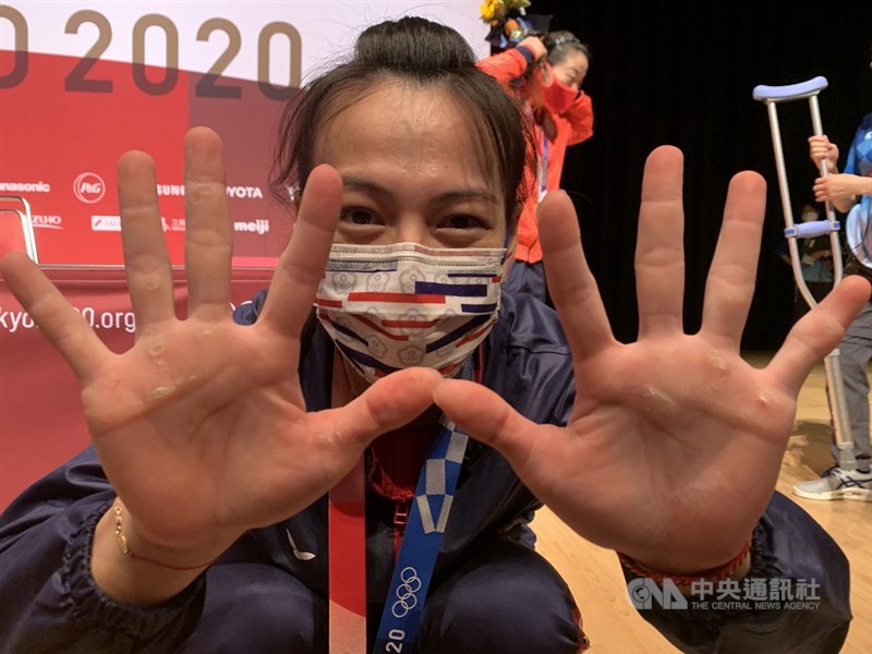 台灣選手在東京奧運締造2金、4銀、6銅的隊史最佳參賽成績,教育部長潘文忠11日呼籲國人,別只看到成功的那一刻,也要看到他們在漫長的挫折中不斷向前的精神和素養。東京奧運舉重金牌的「舉重女神」郭婞淳攤開雙手,可見厚繭裂開痕跡。(中央社檔案照片)