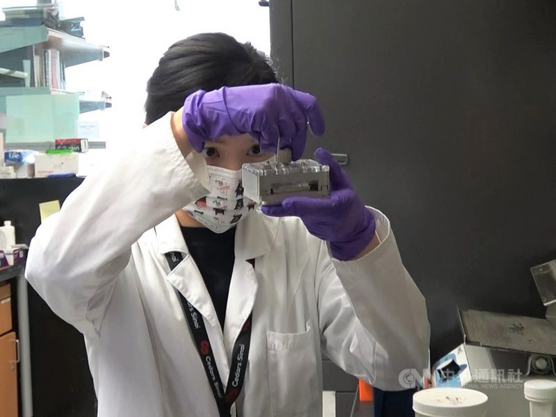 加州大學洛杉磯分校(UCLA)研究團隊8月發表,用奈米魔鬼氈晶片檢測孕婦「植入性胎盤」。中央社記者林宏翰洛杉磯攝 110年8月13日