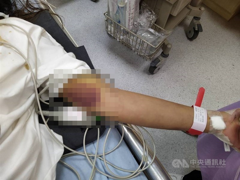 「76行者遺體美容專業修復團隊」總召集人陳修將和女友胡女在汽車旅館發生爭執,讓胡女頭部撞及重物致死,胡女被送進醫院時身上有多處瘀傷,已無氣息。(翻攝照片)中央社記者吳哲豪傳真 110年10月16日