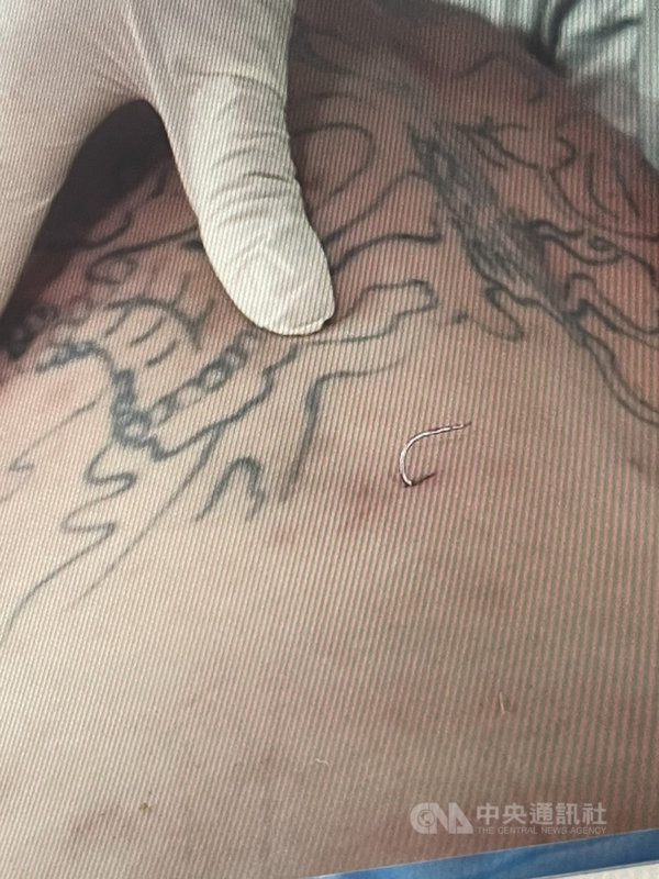黃姓男子疑與另一派人馬有嫌隙,雙方在一家KTV狹路相逢,對方攔下黃男毆打,再押上車載往他處凌虐,甚至用魚鉤插入黃男背部。(翻攝畫面)中央社記者蕭博陽南投縣傳真 110年11月24日