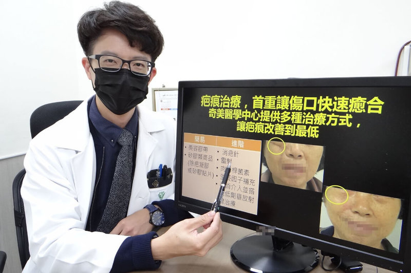 台南一名婦人因騎車自摔右臉嚴重變形,手術後留下明顯疤痕,奇美醫學中心傷口照護中心暨整形外科主治醫師許翰平(圖)擬定計畫協助復原。(院方提供)中央社記者楊思瑞台南傳真 111年1月20日