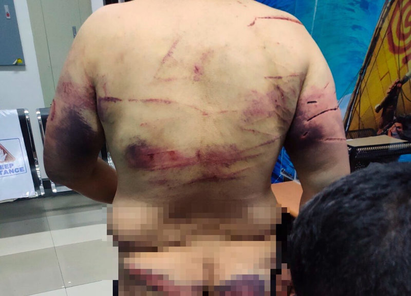 台灣籍謝姓槍砲通緝犯110年8月出境到廈門，之後潛逃菲律賓，在博弈公司工作，卻因合約糾紛遭拘禁施暴。這名男子向駐菲代表處求援後，被菲國警方救出。（代表處提供）中央社記者陳妍君馬尼拉傳真 111年2月5日