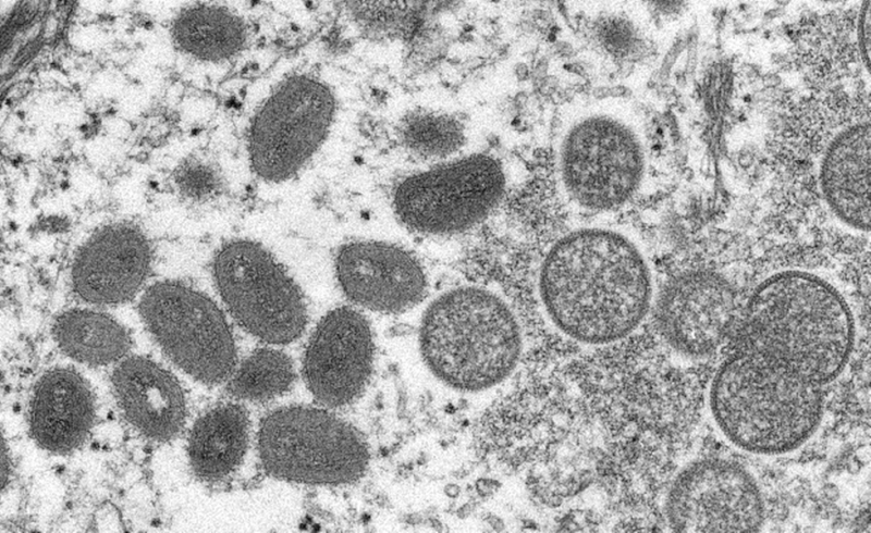 韓國22日通報首起境外移入猴痘病例，成為東亞地區第一個發現猴痘病例的國家。圖為猴痘病毒粒子。（圖取自美國疾管署網頁cdc.gov）